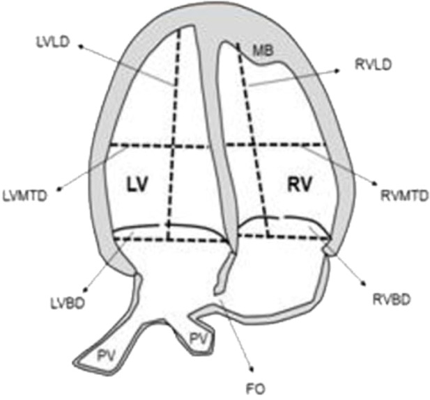 ventricular_dimensions_drawing